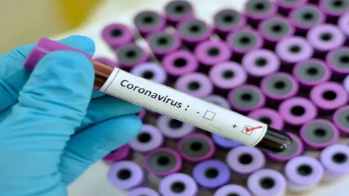 Ermənistan millisinin üzvü koronavirusa yoluxub